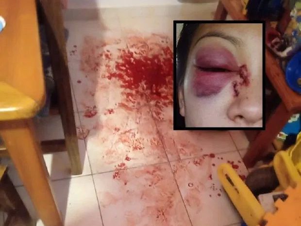 San Martín de los Andes: golpeó a su pareja con un tronco en el rostro