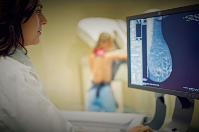 ELIMINAN el CÁNCER de MAMA en una PACIENTE con una VACUNA