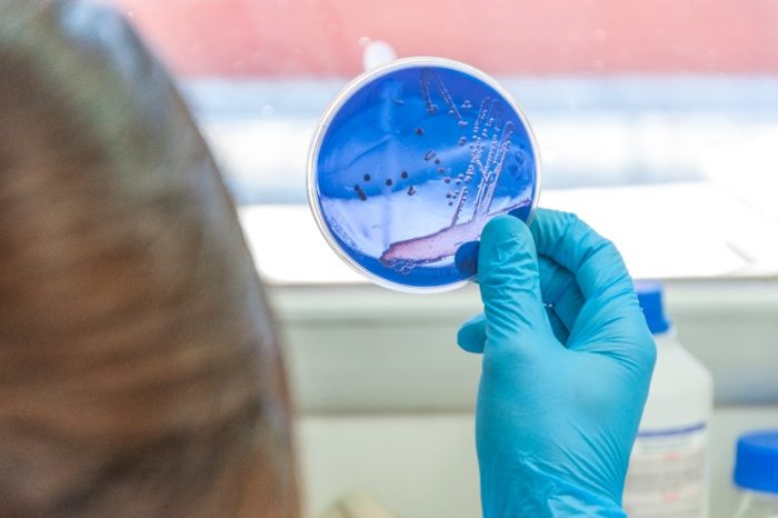 Descubren una especie de bacteria que degrada biomasa