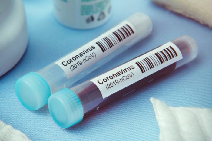 Coronavirus en Argentina: suman 569 los muertos y hay 18.319 casos confirmados