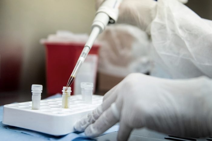 Argentina fue elegida para probar una vacuna contra el coronavirus