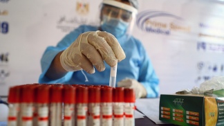 La Anmat aprobó el primer test argentino de diagnóstico basado en tecnología RT-PCR