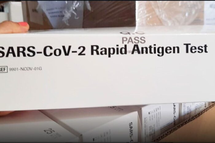Salud compró 30 mil test rápidos para COVID-19