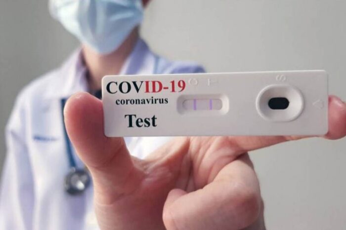 Los primeros autotest estarían disponibles la próxima semana en farmacias, a 1.560 pesos