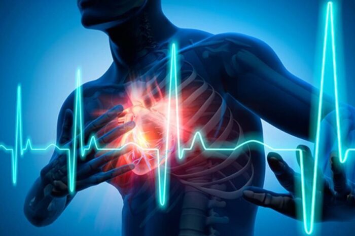 Infartos en el baño: Es importante conocer el por qué?