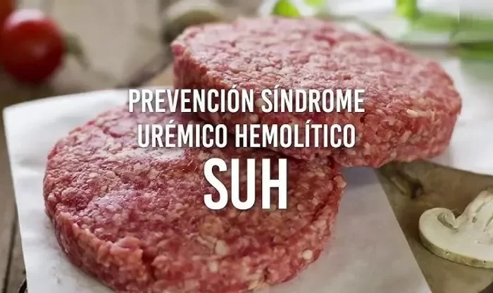 Síndrome Urémico Hemolítico: todo lo que debes saber