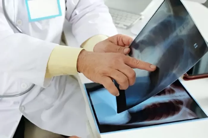 Accesibilidad: Todos los establecimientos de salud realizan análisis de tuberculosis