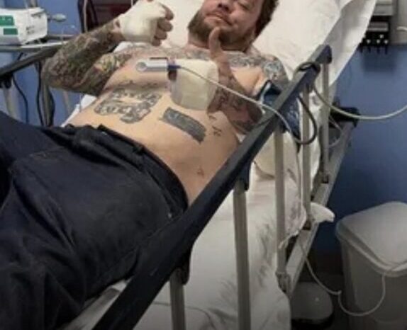 Once costillas rotas y lesiones faciales: Corey Harrison de "El precio de la historia" sufrió un grave accidente en moto